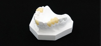 Фотополимерная смола Graphy C&B Crown and Bridge Tera Harz TC-80DP, цвет A2 (1 кг) Фотополимерная смола Graphy C&B Crown and Bridge Tera Harz TC-80DP, цвет A2 (1 кг)