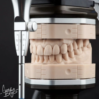 SMOLA Dental Model 12K водосмываемый фотополимер, бежевый (1 кг)