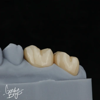 SMOLA Dental Model 12K водосмываемый фотополимер, серый (1 кг) SMOLA Dental Model 12K водосмываемый фотополимер, серый (1 кг)