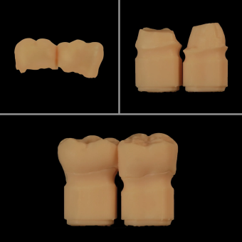 Фотополимерная смола Resione D01 Dental Model термостойкая, оранжевая (1 кг) Фотополимерная смола Resione D01 Dental Model термостойкая, оранжевая (1 кг)